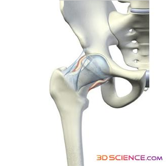 hipjoint graphic